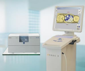 CEREC 3D