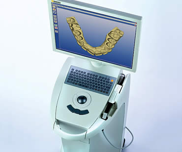 CEREC Explained