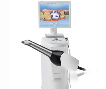 Are You a Candidate for CEREC?